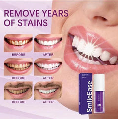 Hismile V34 Teeth Whitening Serum