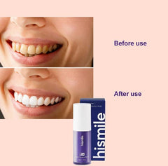 Hismile V34 Teeth Whitening Serum